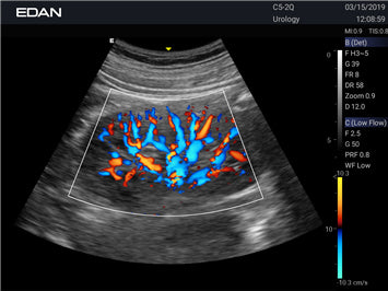 Système d’échographie diagnostique Acclarix LX3 – EDAN