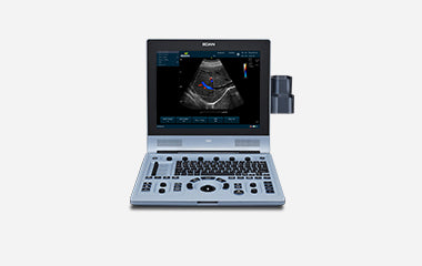 Système d’échographie Doppler couleur portable - EDAN U60