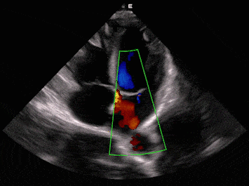 Système d’échographie diagnostique Acclarix LX9 – EDAN