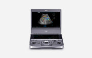EDAN Acclarix AX9 - Échographe diagnostique portable