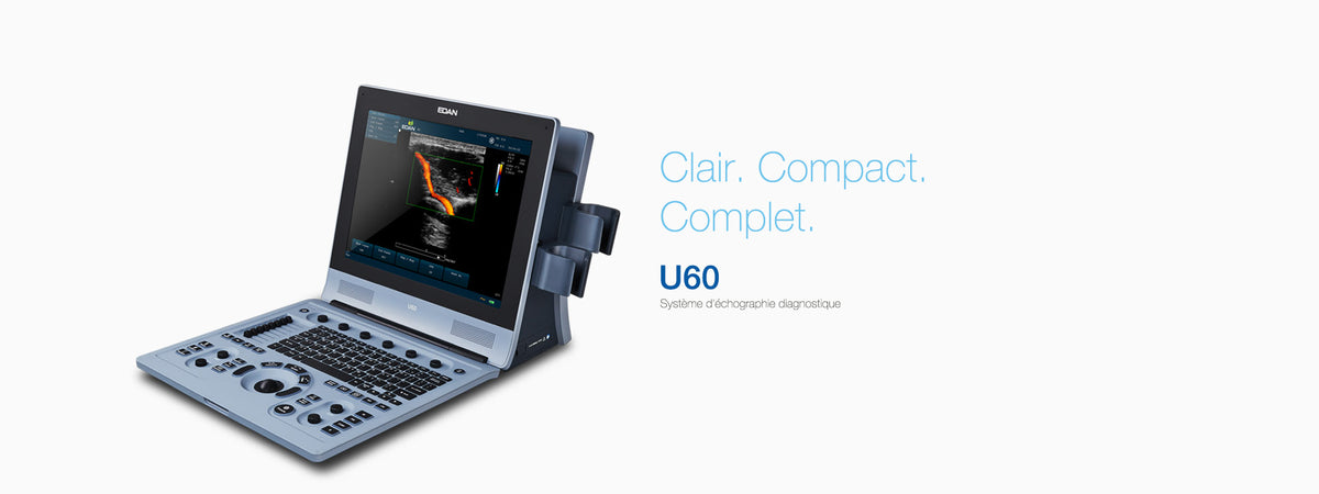 Système d’échographie Doppler couleur portable - EDAN U60