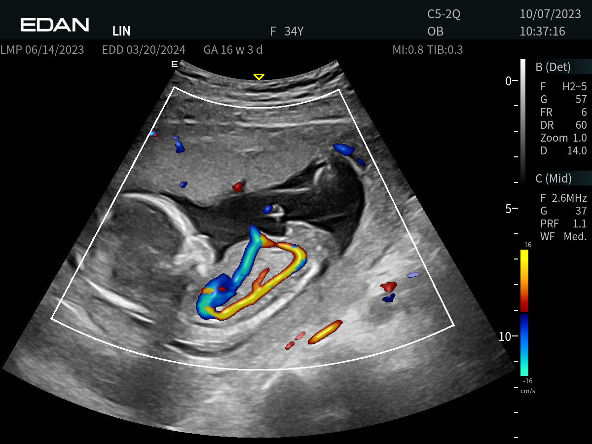 EDAN Acclarix AX9 - Échographe diagnostique portable