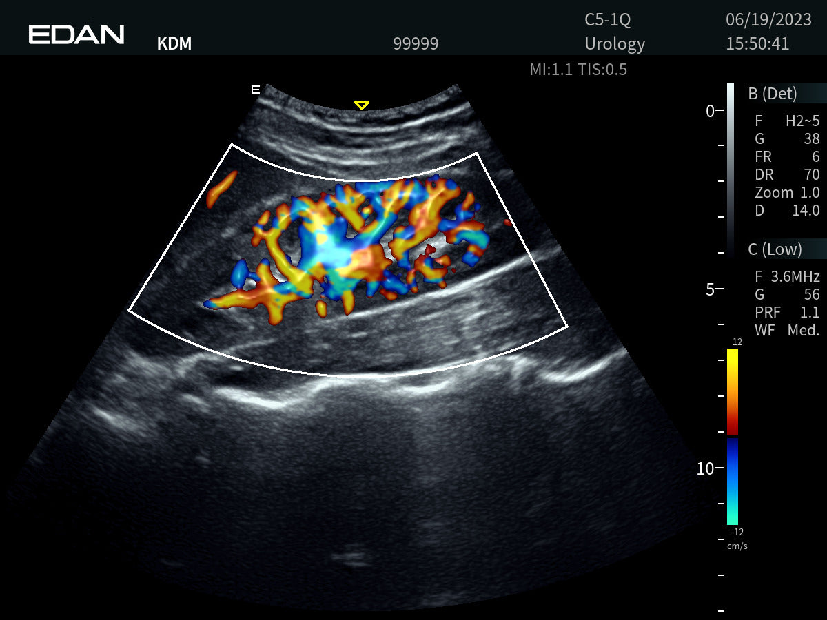 EDAN Acclarix AX9 - Échographe diagnostique portable