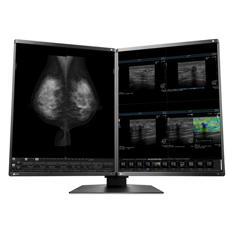 Moniteur médical couleur - RadiForce RX570
