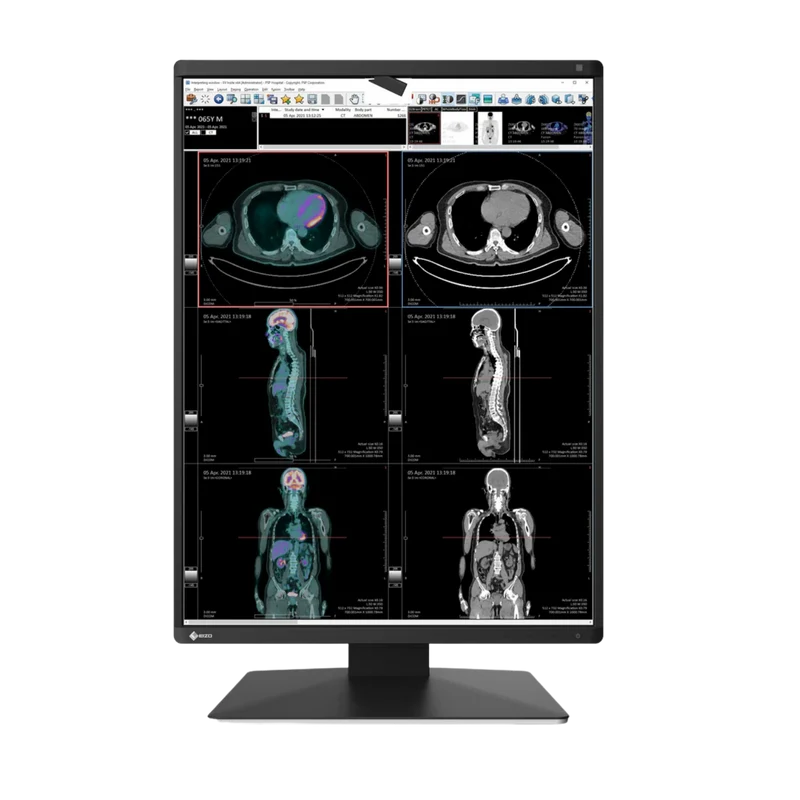 Moniteur médical couleur - EIZO RadiForce RX370