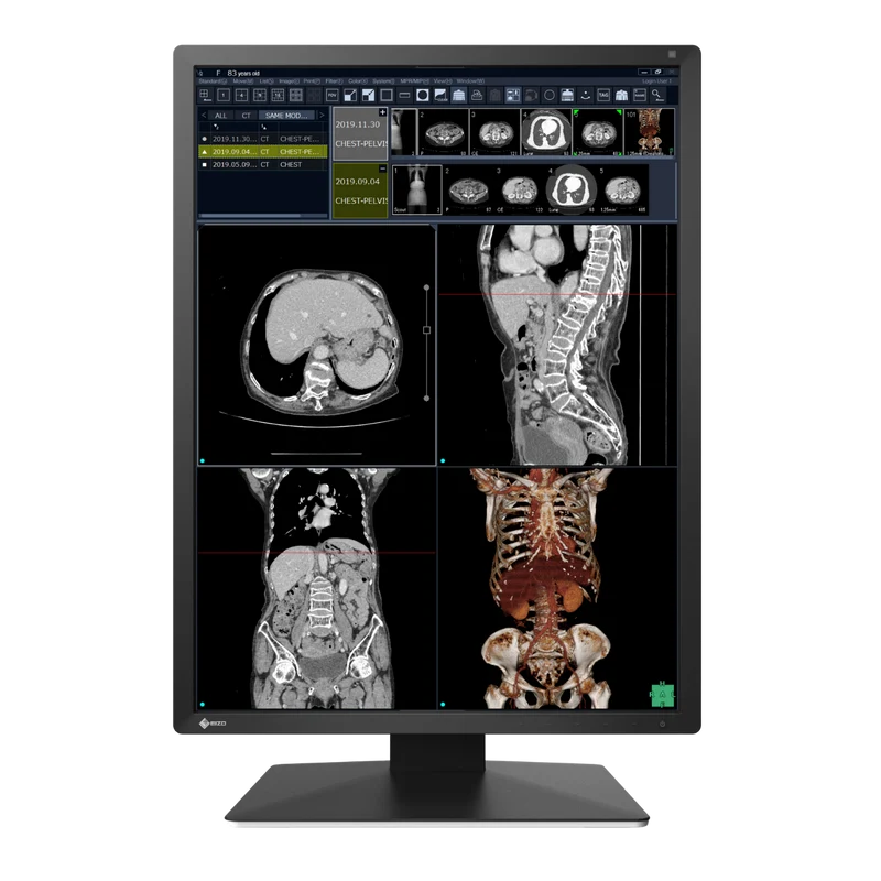 Moniteur médical couleur - EIZO RadiForce RX270