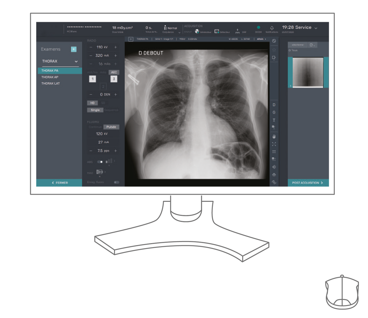 Système de radiographie et fluoroscopie FUJIFILM FDX Visionary RF-Premium NOVA