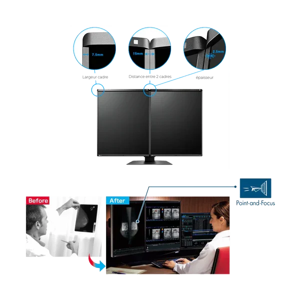 Moniteur médical couleur - RadiForce RX570