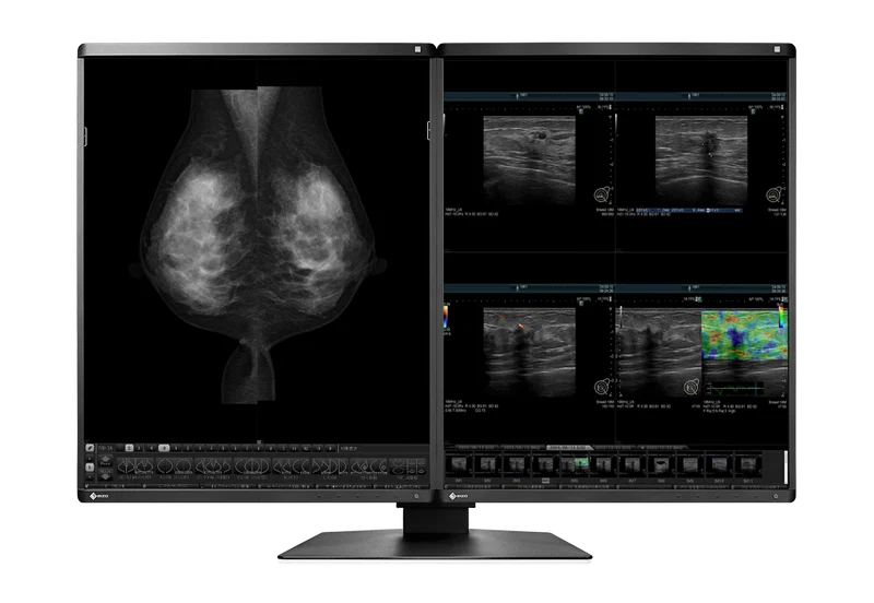 Moniteur médical couleur - RadiForce RX570