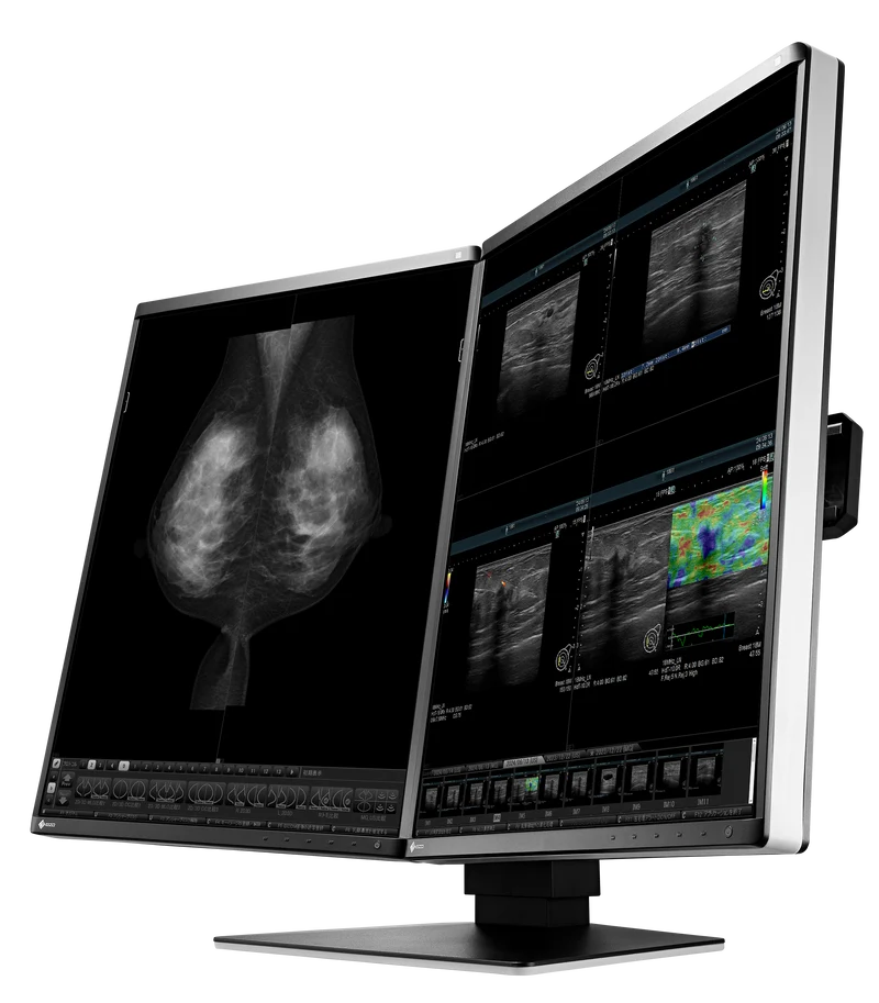 Moniteur médical couleur - RadiForce RX570