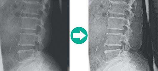 Lecteur de radiographie numérique FUJIFILM FCR PRIMA T