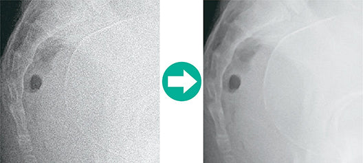 Lecteur de radiographie numérique FUJIFILM FCR PRIMA T