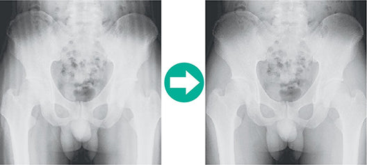 Lecteur de radiographie numérique FUJIFILM FCR PRIMA T