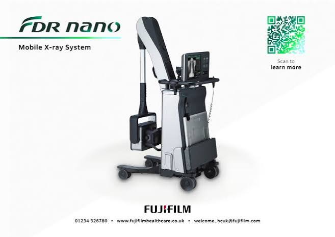 Mobile de radiographie numérique FUJIFILM FDR nano