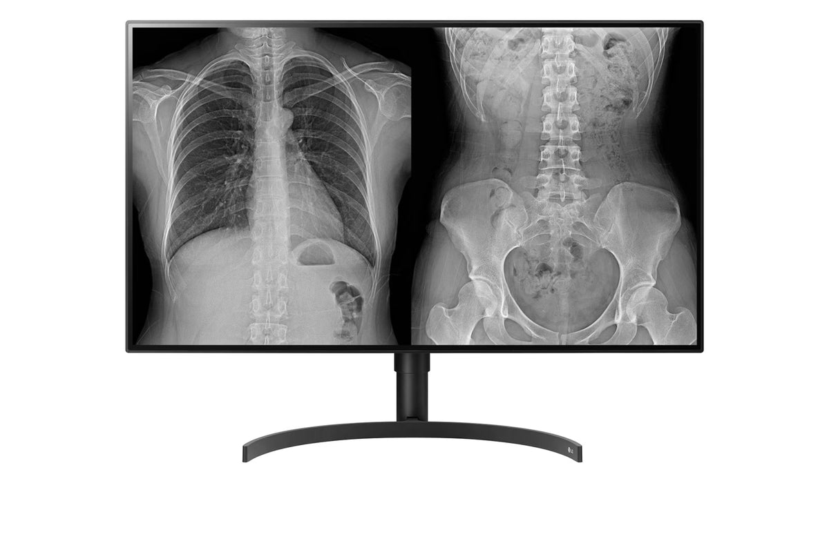 Moniteur médical de diagnostic - LG 32HL512D-B