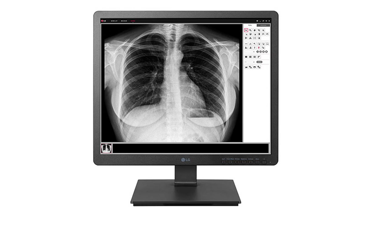 Moniteur médical clinicien - LG 19HK312C-B