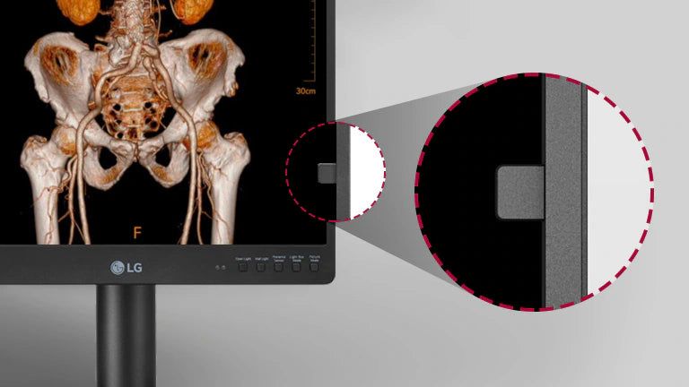 Moniteur médical de diagnostic - LG 21HQ513D-M