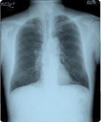 Reprographe laser sec FUJIFILM DRYPIX Smart