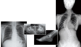 Lecteur de radiographie numérique FUJIFILM FCR CAPSULA XLII
