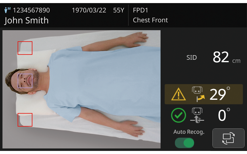 Mobile de radiographie numérique FUJIFILM FDR Go iQ