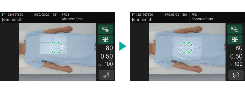 Mobile de radiographie numérique FUJIFILM FDR Go iQ