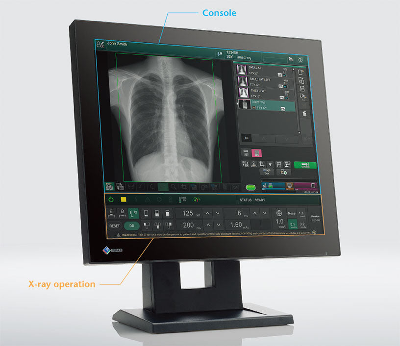 Systèmes de radiographie numérique FUJIFILM FDR Smart X