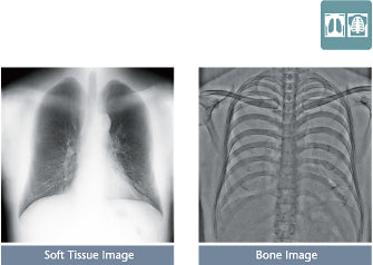 Systèmes de radiographie numérique FUJIFILM FDR Visionary Suite