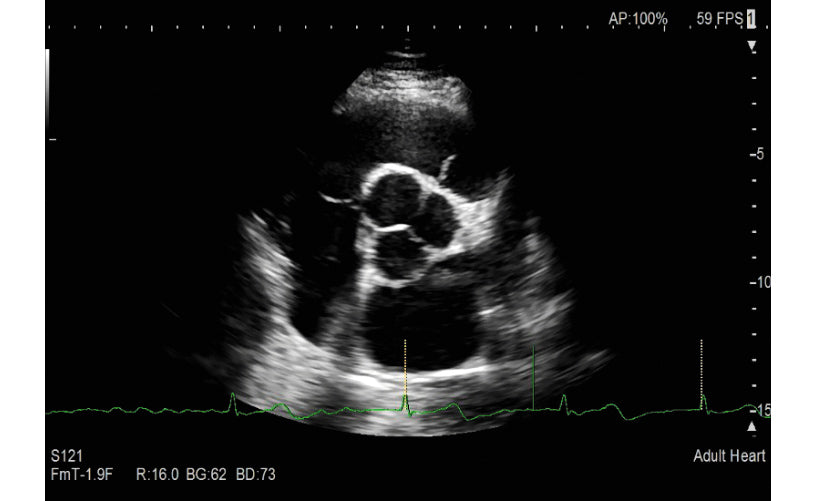 Échographe cardiovasculaire FUJIFILM LISENDO 880LE