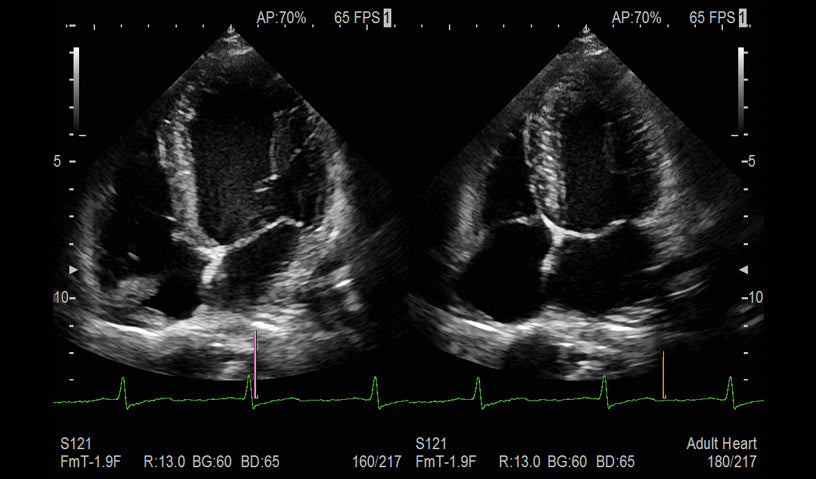 Échographe cardiovasculaire FUJIFILM LISENDO 880LE