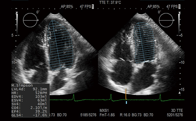 Échographe cardiovasculaire FUJIFILM LISENDO 880LE