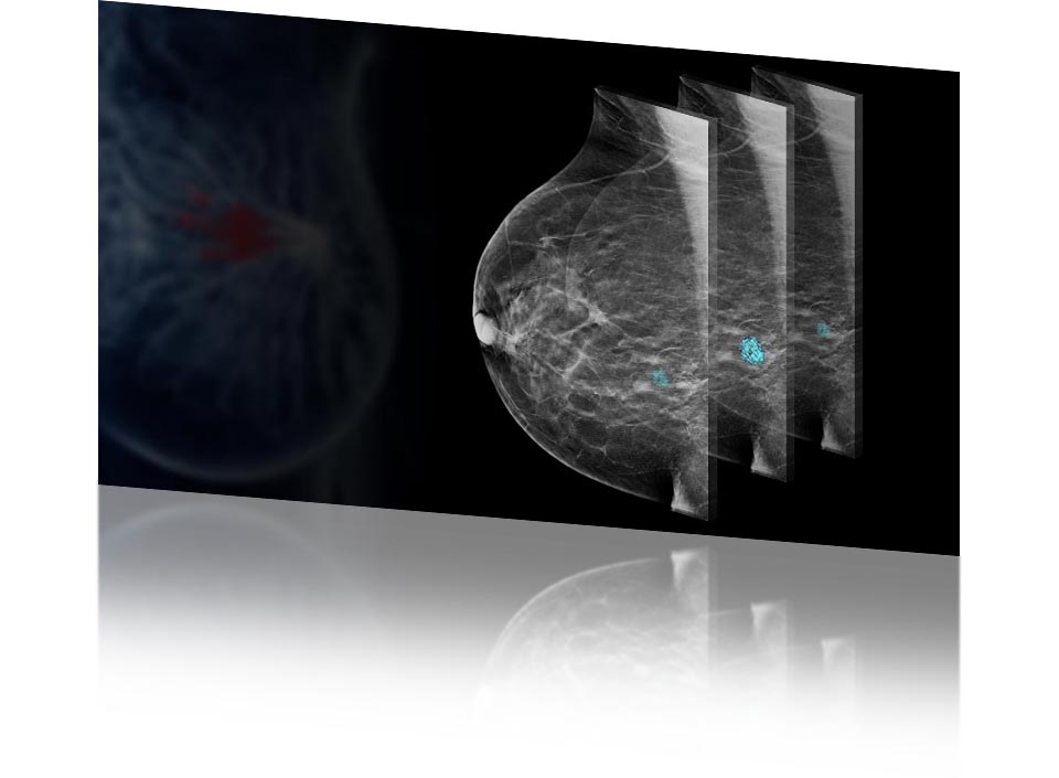 Mammographe numérique MAMMOGRAPH D-TOMO+ ITALRAY